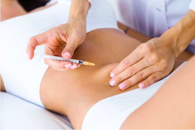 carboxiterapia