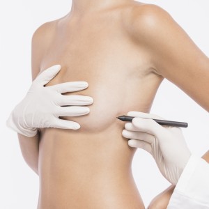 Lipoimplante mamario