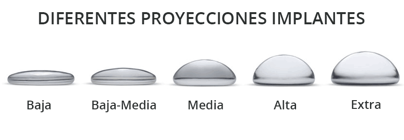 Proyección de prótesis de mama